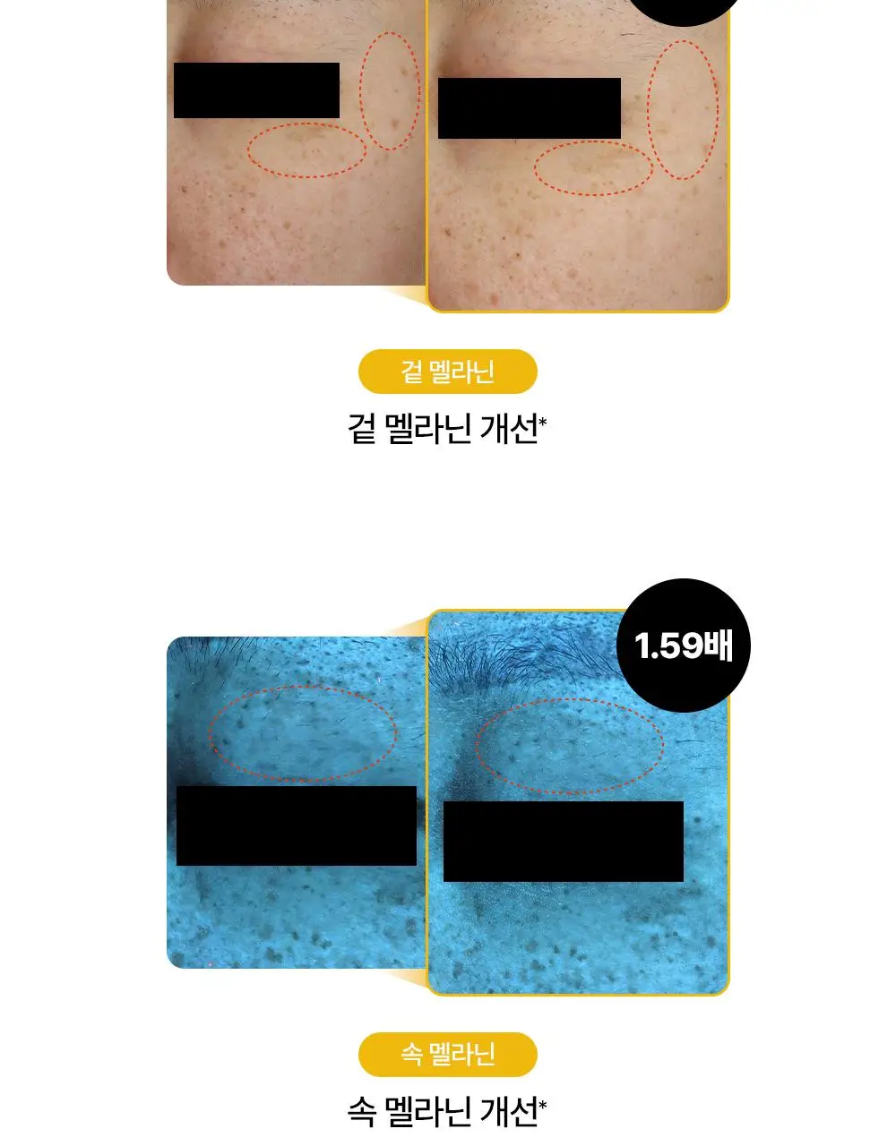 [잡티저격/TXA] 퍼셀 80억/mL 글루타치온 TXA 캡슐 크림 80ml 상세페이지 12